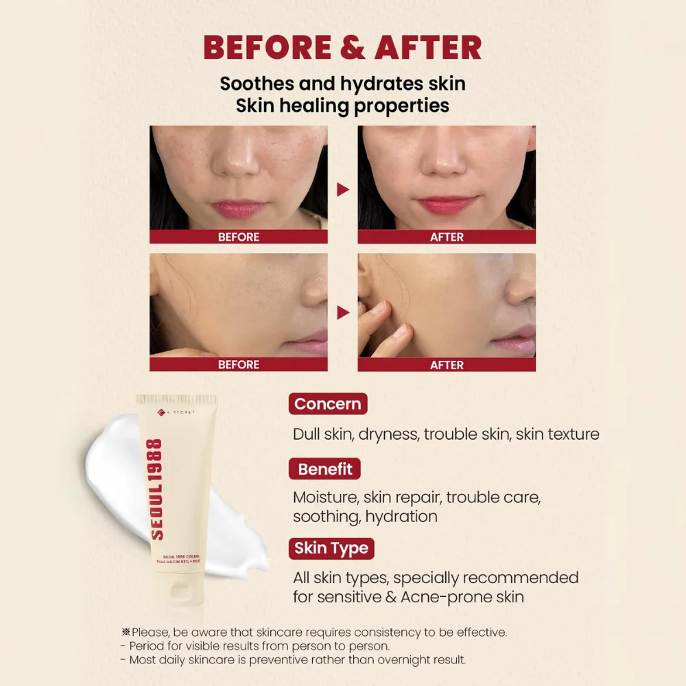 K-Secret Seoul 1988 cream uk K-Secret Seoul 1988 cream uk