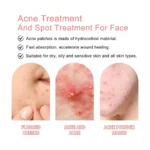 acne absorbing patches