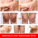 best elbow and knee whitening cream