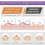 scar silicone sheets