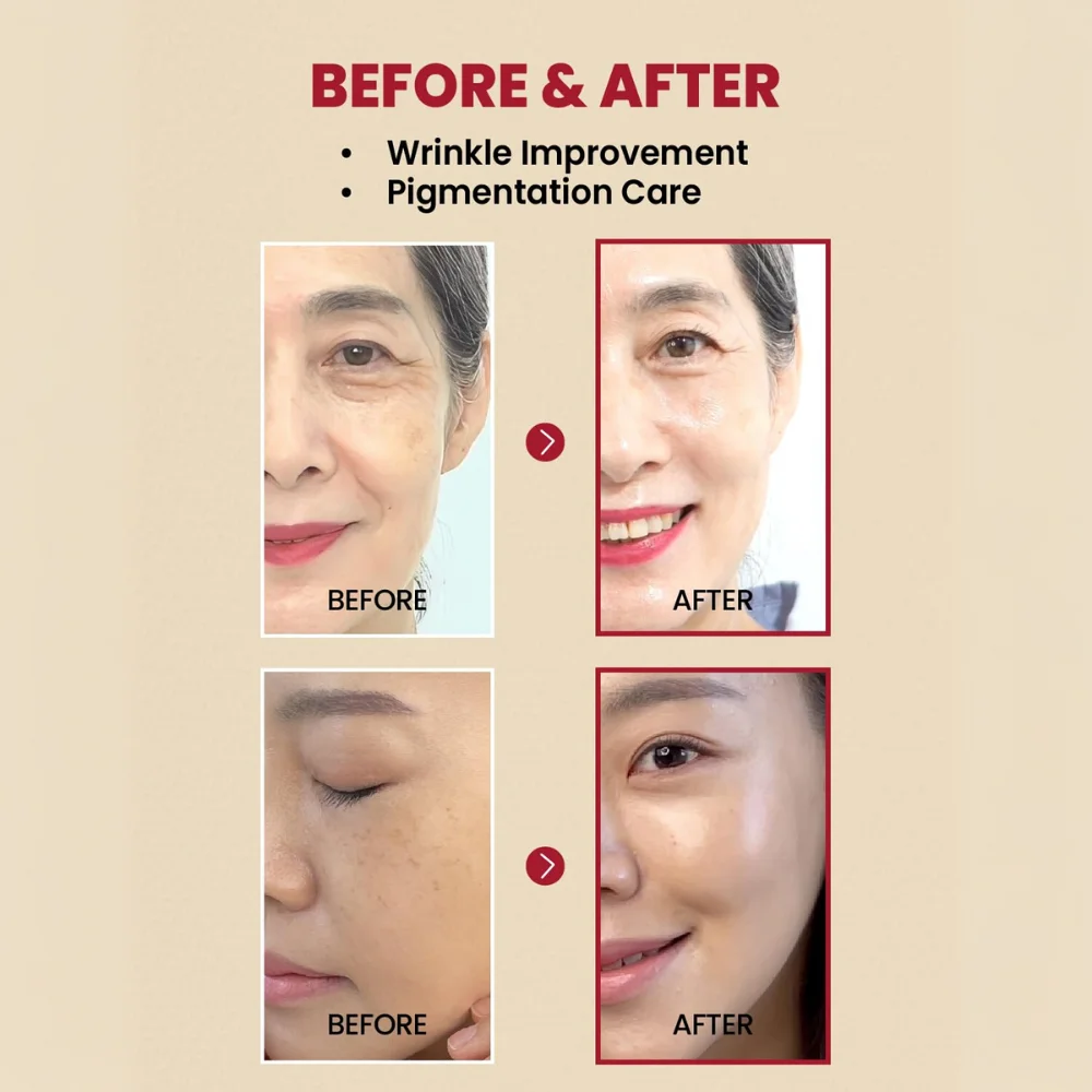 seoul 1988 retinal serum