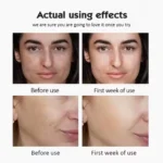 vitamin c ampoules serum