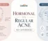 Hormonal Acne vs Regular Acne Key Differences