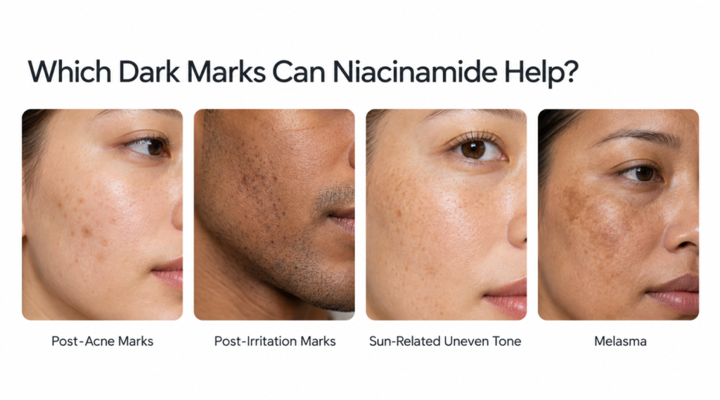 What Kind of Hyperpigmentation Responds Best to Niacinamide?